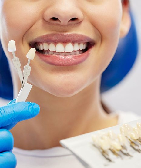 Nose-to-shoulder view of woman in dental chair with shade guide held to smile